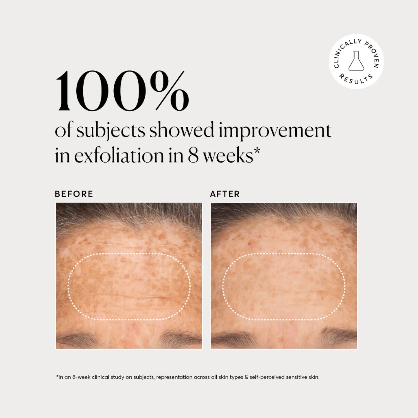 bha-liquid-exfoliant-2-f5 NATR-10027-Alt-Images-BHA-Liquid-Exfoliant-2_-03.webp